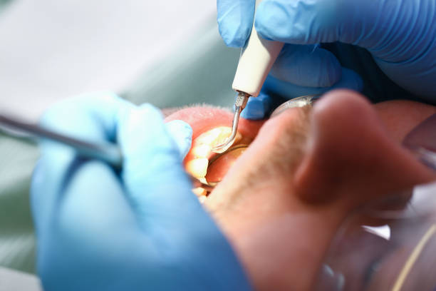 Best Weekend Emergency Dentist in Oak Leaf, TX