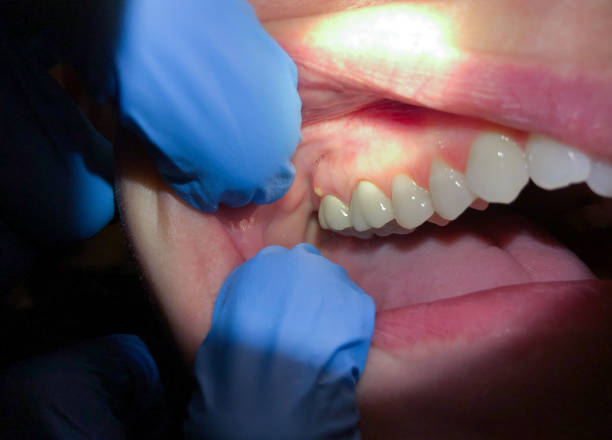 Best Pediatric Emergency Dentist in Oak Leaf, TX